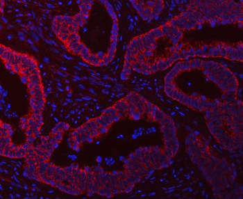 SCO1 Rabbit Polyclonal Antibody