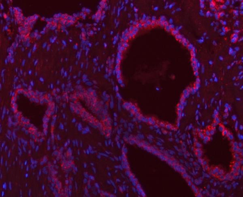 SCO1 Rabbit Polyclonal Antibody