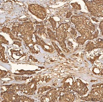 SCO1 Rabbit Polyclonal Antibody