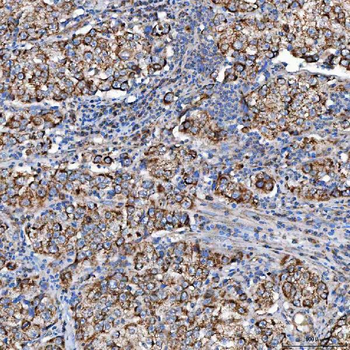 SCO1 Rabbit Polyclonal Antibody