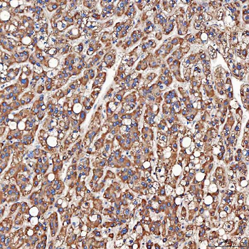 SCO1 Rabbit Polyclonal Antibody