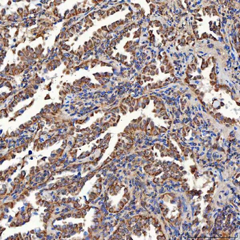 SCO1 Rabbit Polyclonal Antibody