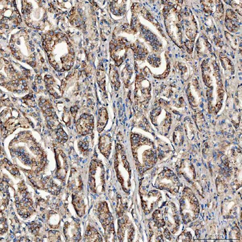 SCO1 Rabbit Polyclonal Antibody
