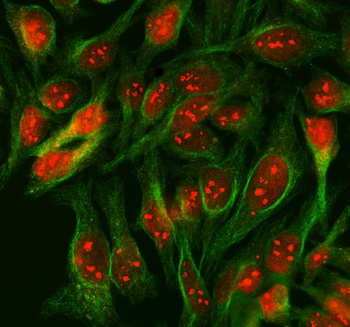 SCML1 Rabbit Polyclonal Antibody