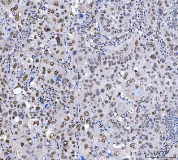 SCML1 Rabbit Polyclonal Antibody