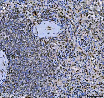 SCML1 Rabbit Polyclonal Antibody