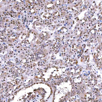 SCML1 Rabbit Polyclonal Antibody