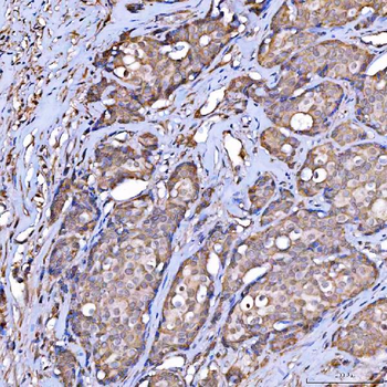 Scavenging Receptor SRB2/SCARB2 Rabbit Polyclonal Antibody