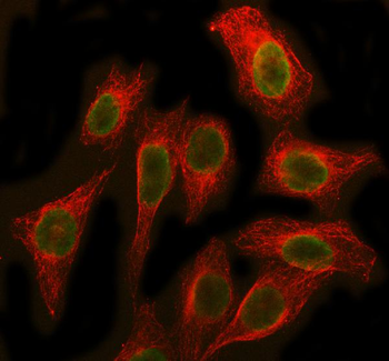 SBDS Rabbit Polyclonal Antibody