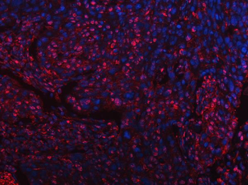 SART3 Rabbit Polyclonal Antibody