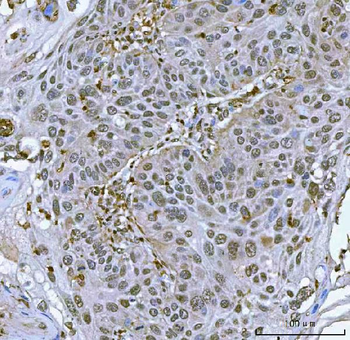 SART3 Rabbit Polyclonal Antibody