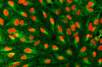 SART1 Rabbit Polyclonal Antibody