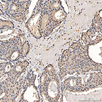 SART1 Rabbit Polyclonal Antibody