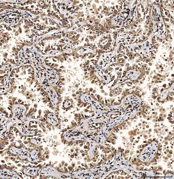 SART1 Rabbit Polyclonal Antibody