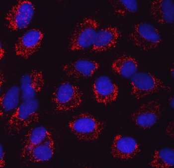SARS2 Rabbit Polyclonal Antibody