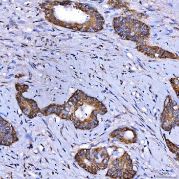 SARS2 Rabbit Polyclonal Antibody