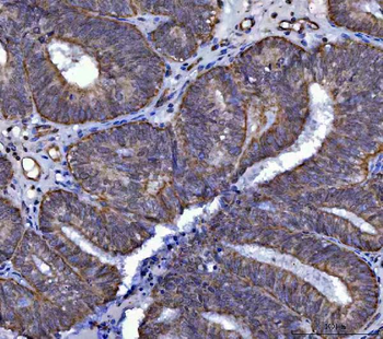 SARS2 Rabbit Polyclonal Antibody