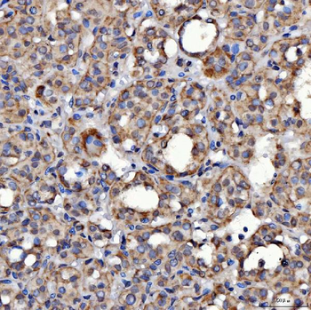 SARS2 Rabbit Polyclonal Antibody