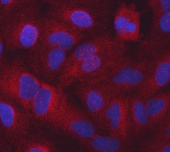 Seryl-tRNA synthetase/SERS/SARS1 Rabbit Polyclonal Antibody