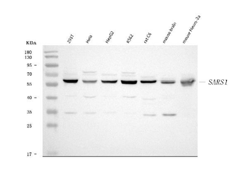 Seryl-tRNA synthetase/SERS/SARS1 Rabbit Polyclonal Antibody