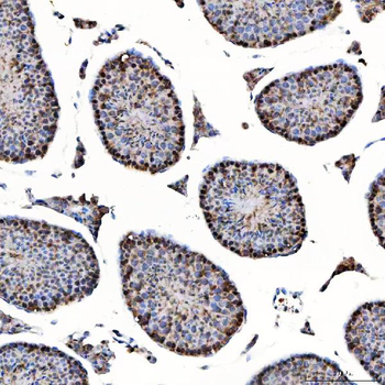 SAP130 Rabbit Polyclonal Antibody