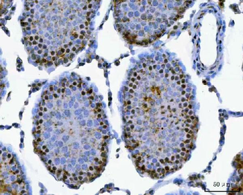 SAP130 Rabbit Polyclonal Antibody