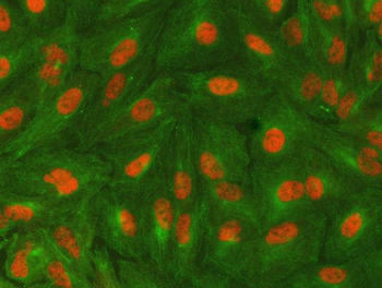 SAP130 Rabbit Polyclonal Antibody