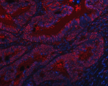 SAP130 Rabbit Polyclonal Antibody