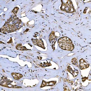 SAP130 Rabbit Polyclonal Antibody