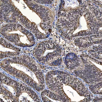 SAP130 Rabbit Polyclonal Antibody