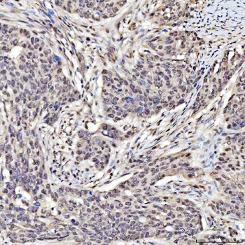 SAP130 Rabbit Polyclonal Antibody