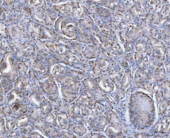 SAP130 Rabbit Polyclonal Antibody