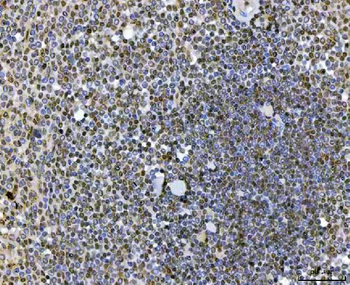 SAP130 Rabbit Polyclonal Antibody
