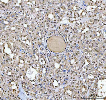 SAP130 Rabbit Polyclonal Antibody