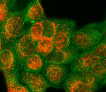 SAP18 Rabbit Polyclonal Antibody
