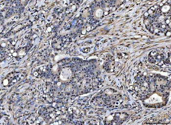 SAP18 Rabbit Polyclonal Antibody