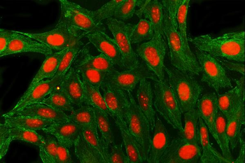 SAE1 Rabbit Polyclonal Antibody
