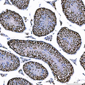 SAE1 Rabbit Polyclonal Antibody