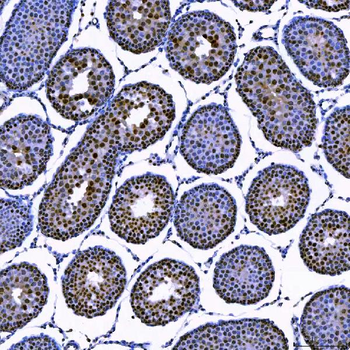 SAE1 Rabbit Polyclonal Antibody