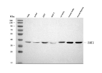 SAE1 Rabbit Polyclonal Antibody