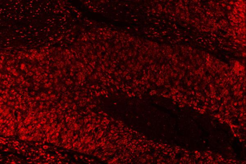 SAE1 Rabbit Polyclonal Antibody