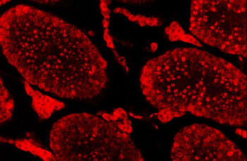 SAE1 Rabbit Polyclonal Antibody