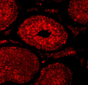 SAE1 Rabbit Polyclonal Antibody