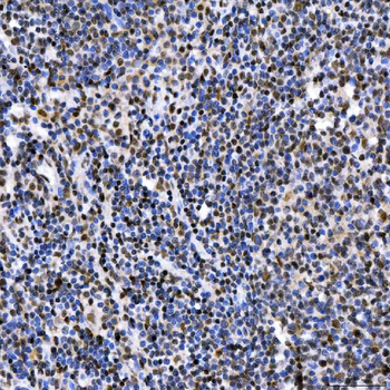 SAE1 Rabbit Polyclonal Antibody