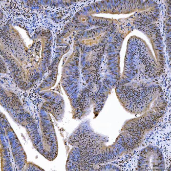 SAE1 Rabbit Polyclonal Antibody