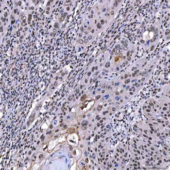 SAE1 Rabbit Polyclonal Antibody
