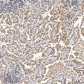SAE1 Rabbit Polyclonal Antibody