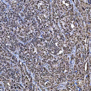 SAE1 Rabbit Polyclonal Antibody