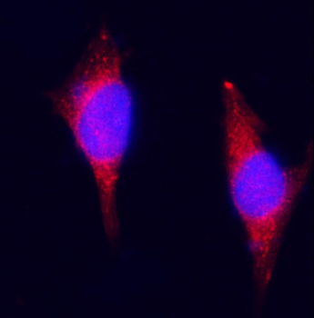 ZAC/Plagl1 Rabbit Polyclonal Antibody