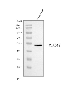 ZAC/Plagl1 Rabbit Polyclonal Antibody